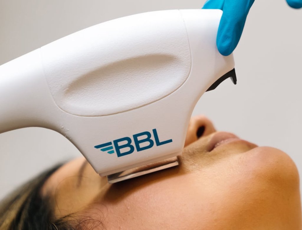 BBL Machine Treatment