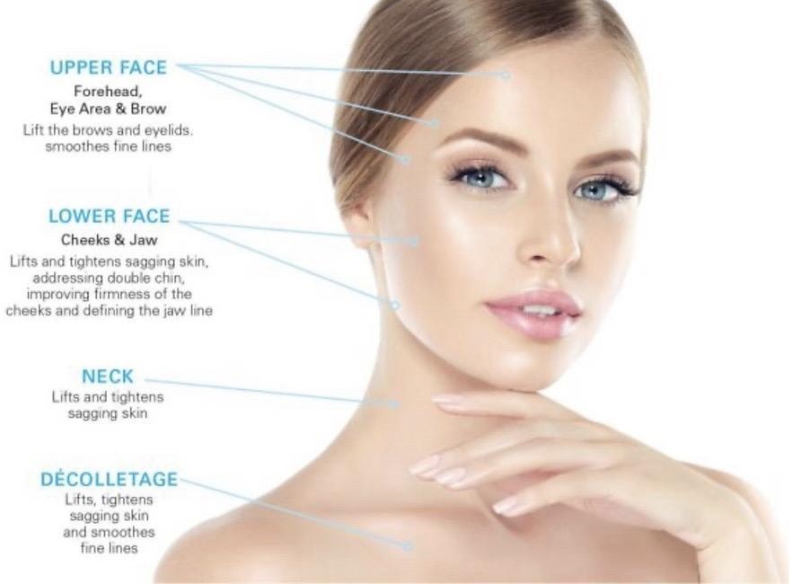 Botox Facial Areas