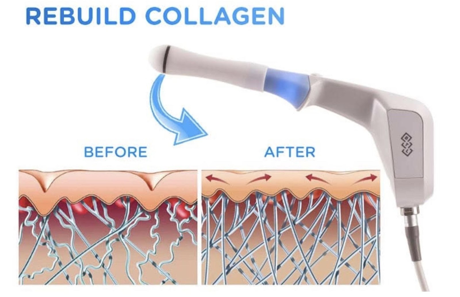 Rebuild Collagen